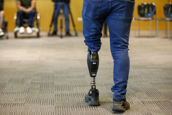Persona con prótesis de pierna izquierda